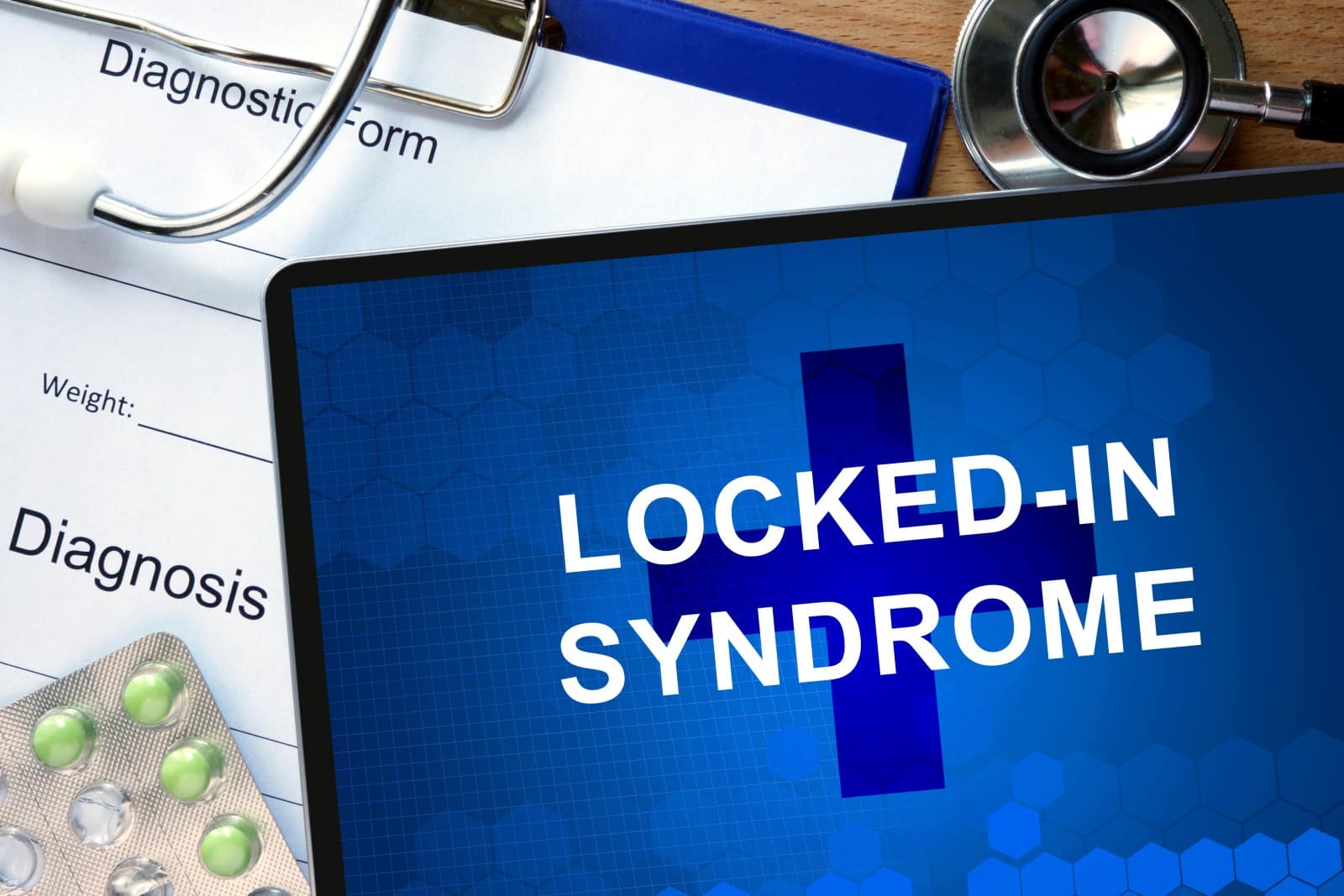 what-is-locked-in-syndrome-mcnicholas-mcnicholas